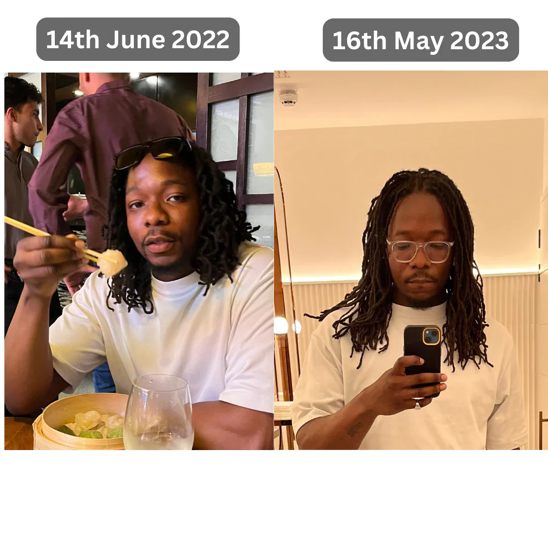 The Ultimate Hair Growth Set for Black Hair - Image 4
